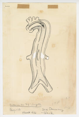 Illustration, p. 113: “Cardiac Clinic: Dissecting Aneurysm of the Aorta” ink drawing