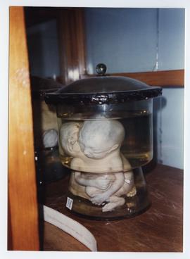 Med school [Fetuses in jar]