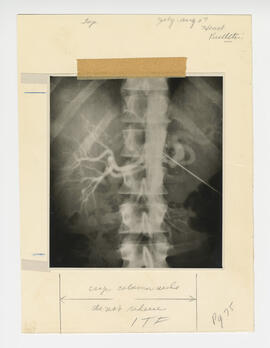 Illustration, p. 75: X-ray image of spine