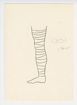 Illustration, p. 75: “Varicose Veins #19” drawing of a bandaged leg