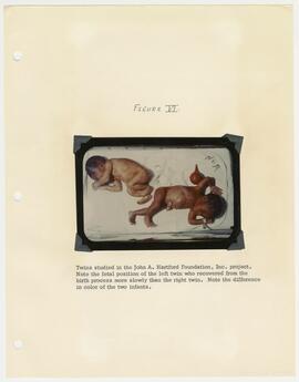 Figure VI, Hartford Project Progress Report, 1962