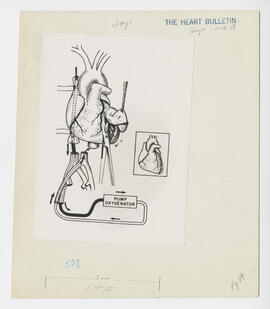 Illustration, p. 89: “Surgical Treatment in Myocardial Infarction” illustration